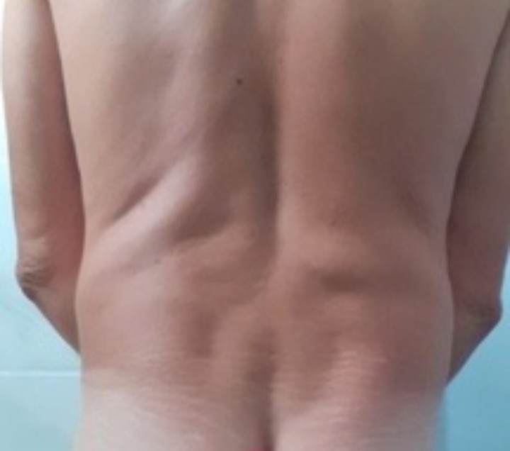 Perfil de Beni